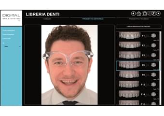 Digital Smile System (3)