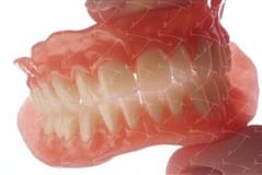 Total Prothesis in Acrylic  Resin with Teeth made of …  con denti del commercio in ceramica abbottonata su denti naturali