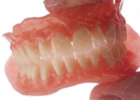 Total Prothesis in Acrylic  Resin with Teeth made of …  con denti del commercio in ceramica abbottonata su denti naturali