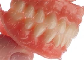 Total Prothesis in Acrylic  Resin with Teeth made of … con denti del commercio in ceramica abbottonata su denti naturali