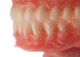 Total Prothesis in Acrylic  Resin with Teeth made of … con denti del commercio in ceramica abbottonata su denti naturali