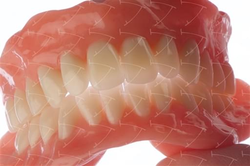 Total Prothesis in Acrylic  Resin with Teeth made of …  con denti del commercio in ceramica abbottonata su impianti