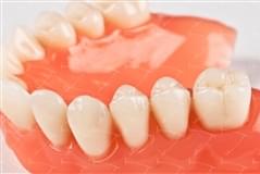 Total Prothesis in Acrylic  Resin with Teeth made of …con denti del commercio in ceramica