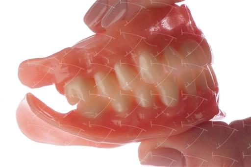 Total Prothesis in Acrylic  Resin with Teeth made of …  con denti del commercio in composito abbottonata su impianti