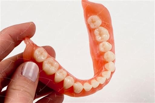 Protesi totale in resina acrilica con denti del commercio in ceramica abbottonata su impianti