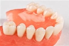 Protesi totale in resina acrilica con denti del commercio in ceramica