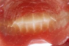 Protesi totale in resina acrilica con denti del commercio in composito