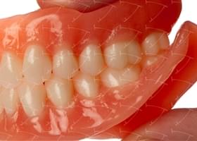 Protesi totale in resina acrilica con denti del commercio in resina acrilica abbottonata su impianti