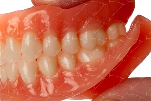 Protesi totale in resina acrilica con denti del commercio in resina acrilica abbottonata su impianti