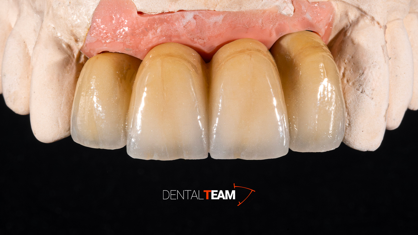 Corone cr-co ceramica