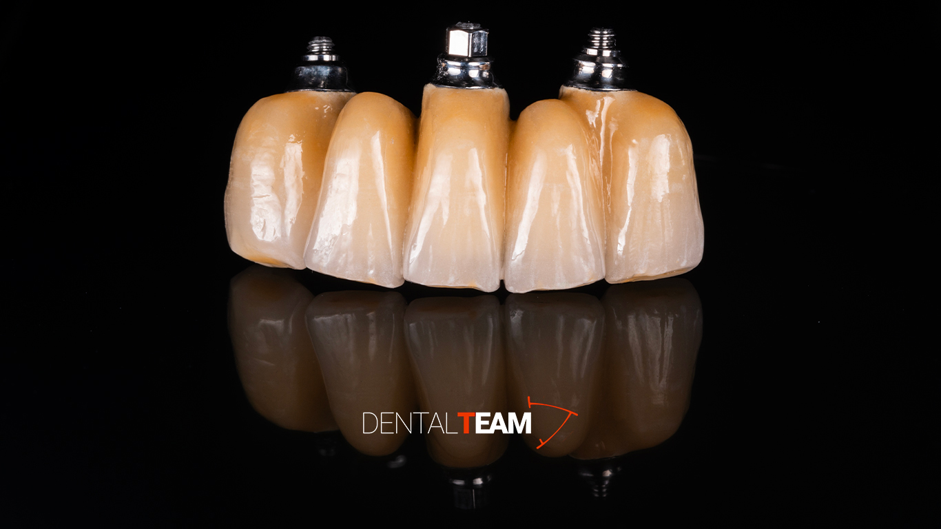 Corone zirconio ceramica