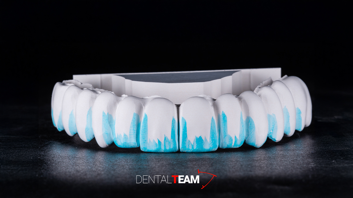 Zirconia monolitica